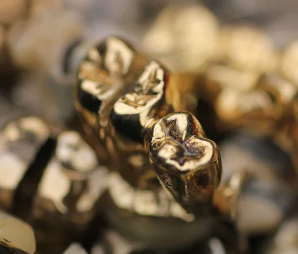 silber- und goldfarbenes Zahngold