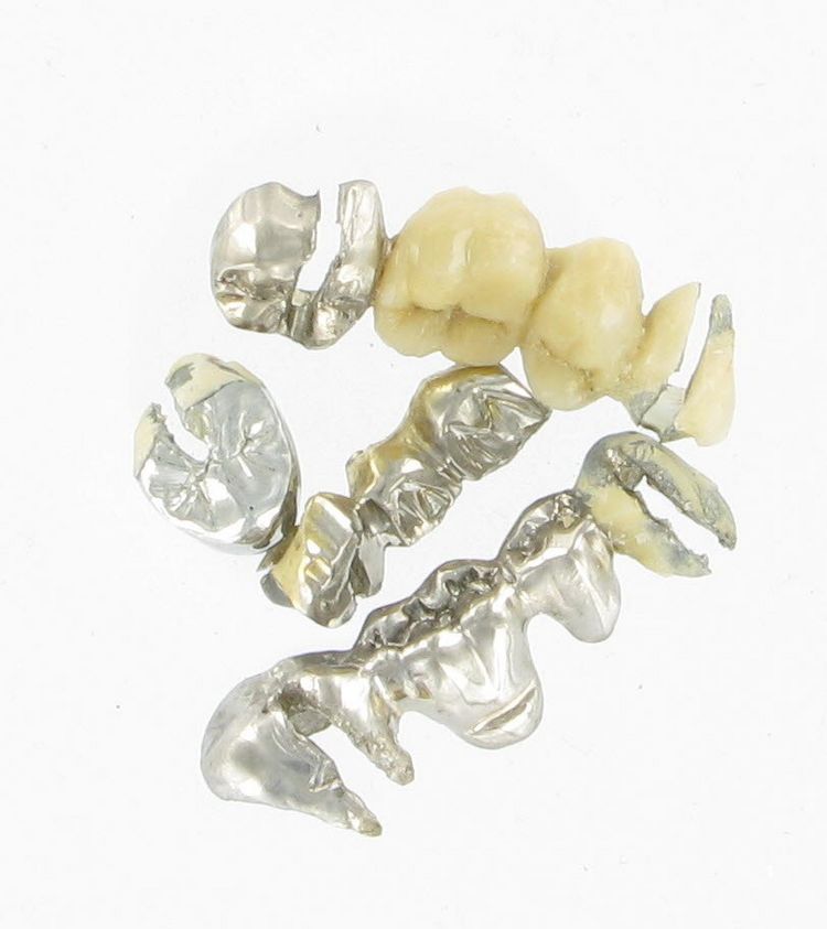 Silberfarbenes Zahngold Silberfarbenes Zahngold